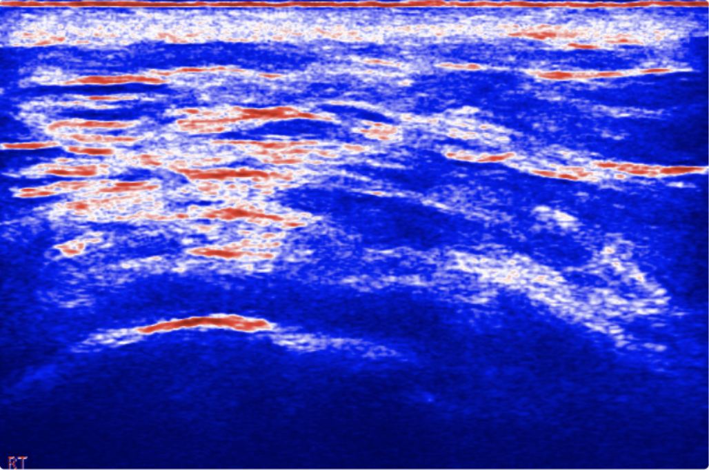 Color-coded pliability analysis with blue and red regions