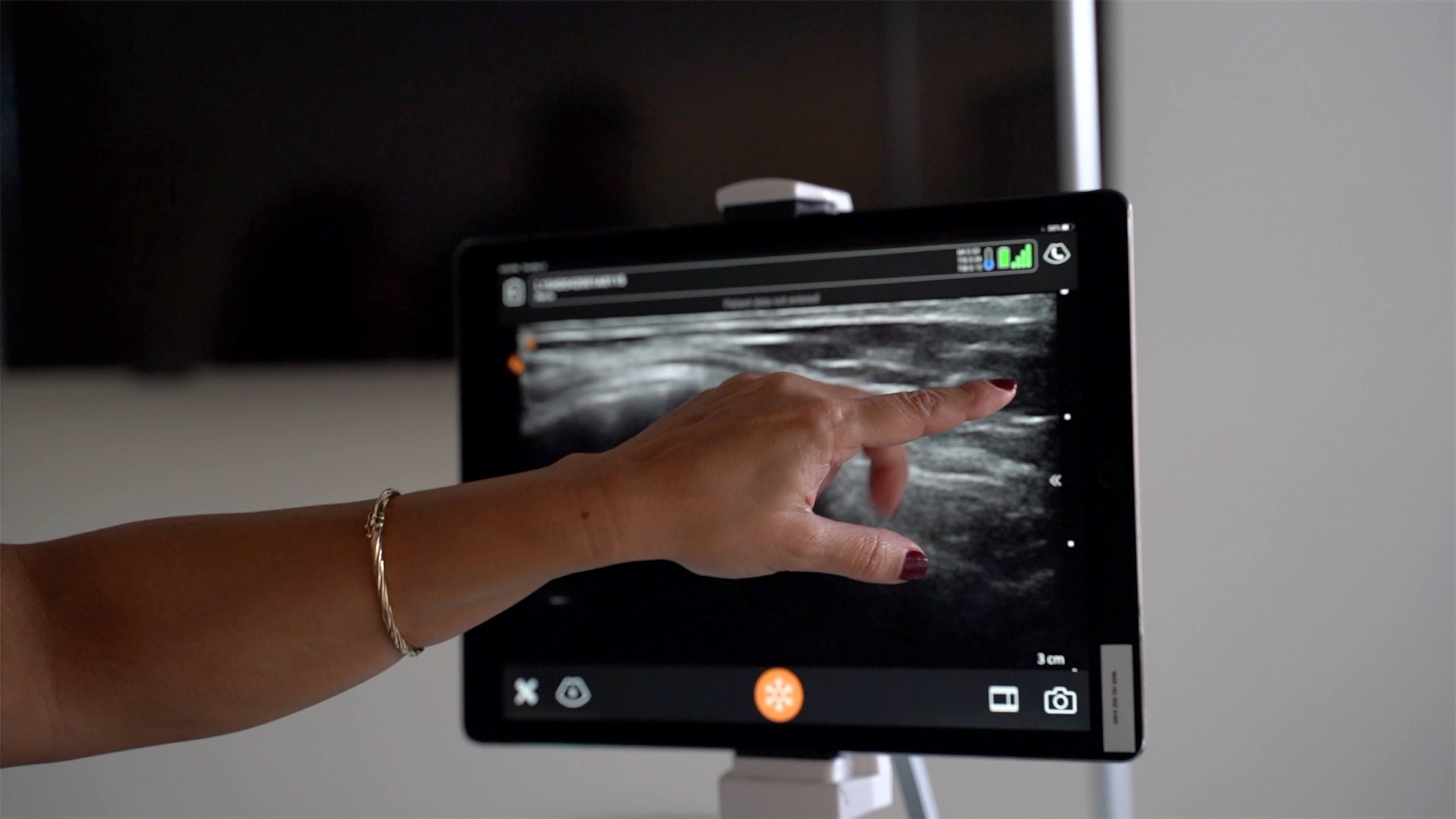 Healthcare professional analyzing ultrasound tissue scan on tablet device